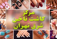 مرکز کاشت ناخن شرق تهران